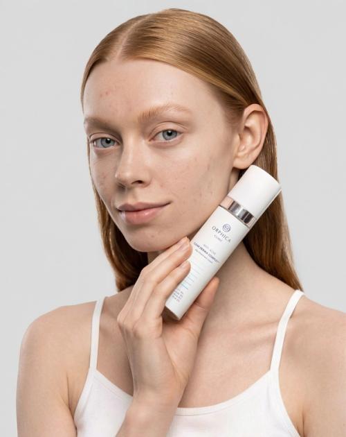 Anti-acne cream tube held on-model in skincare photography — GoPackshot studio