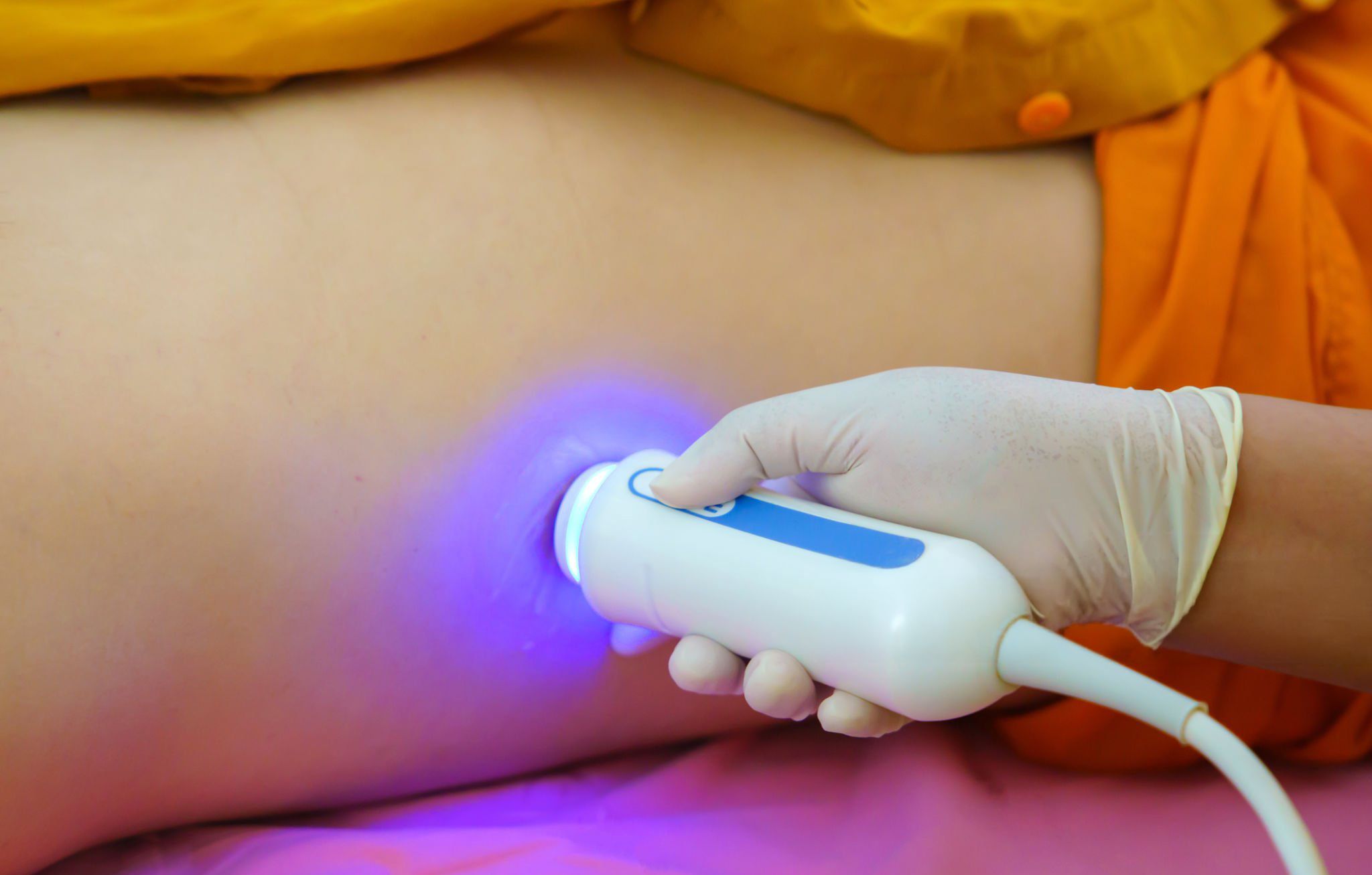 FibroScan Image