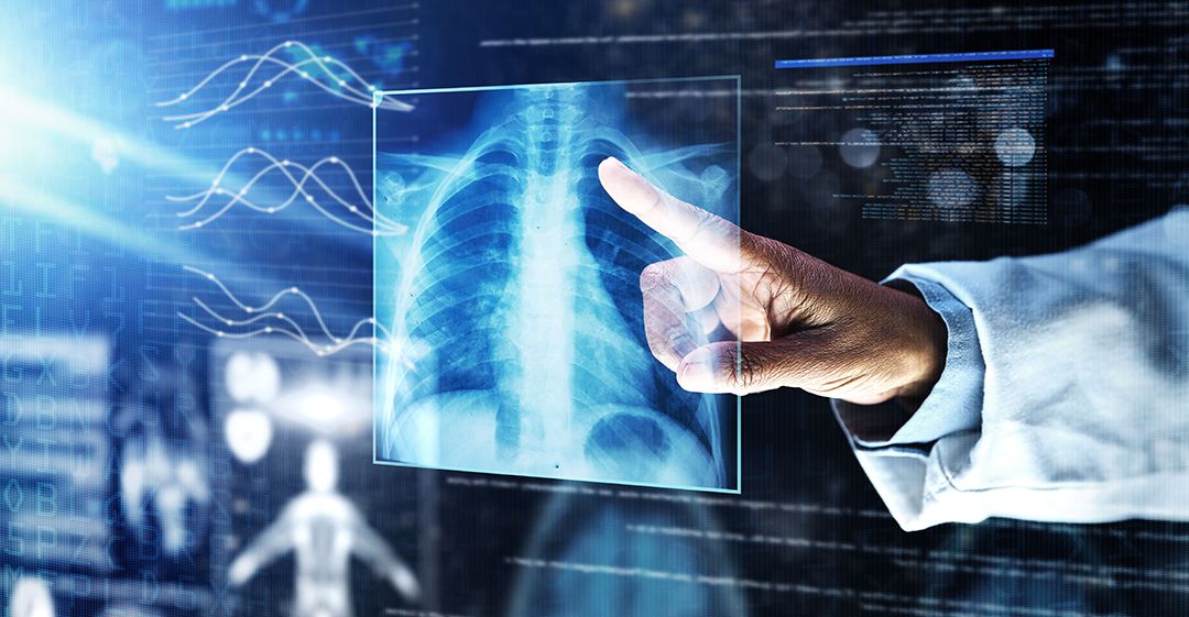 General X-ray photo