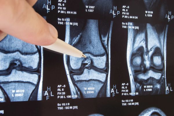 Orthopedic Surgery