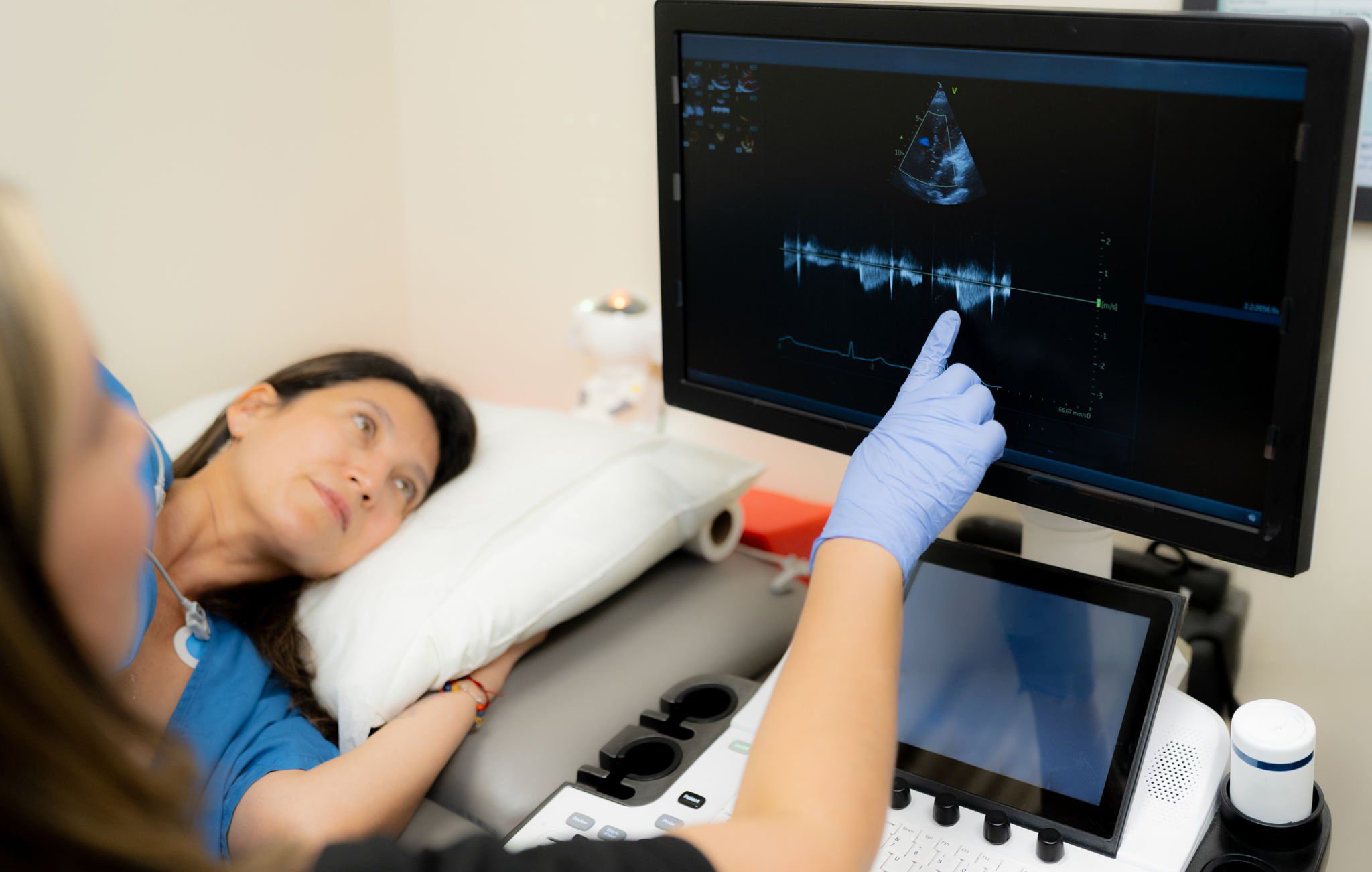 Echocardiography photo