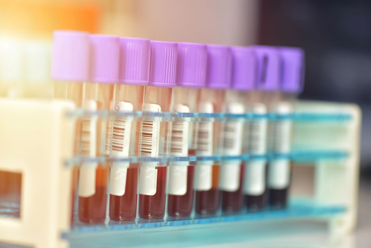 Laboratory Image
