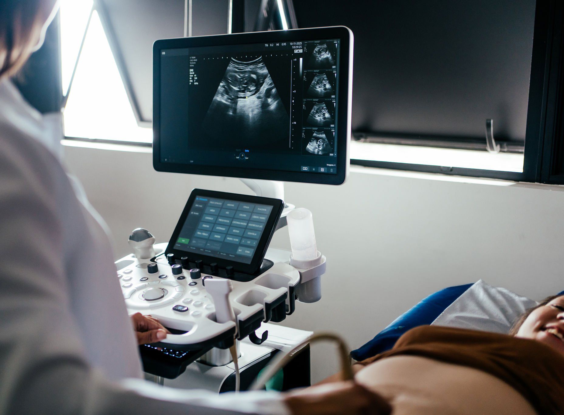Ultrasound photo