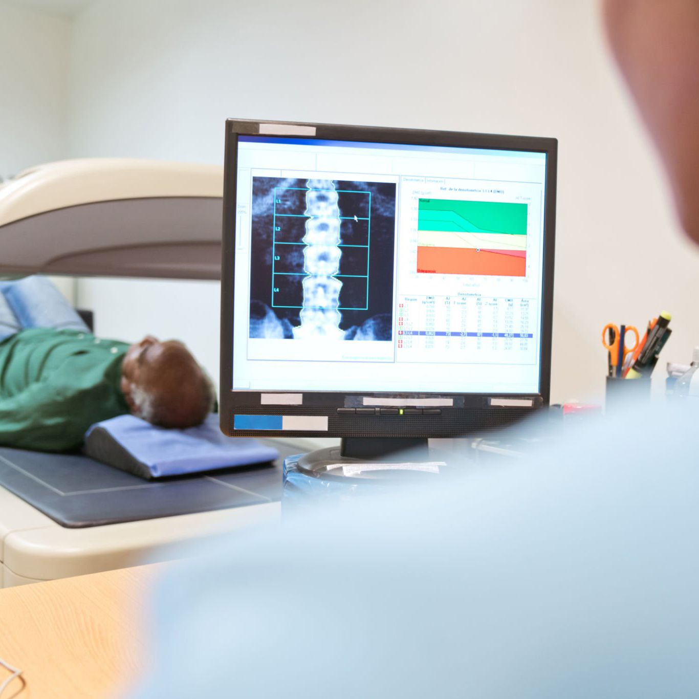 Bone Density photo