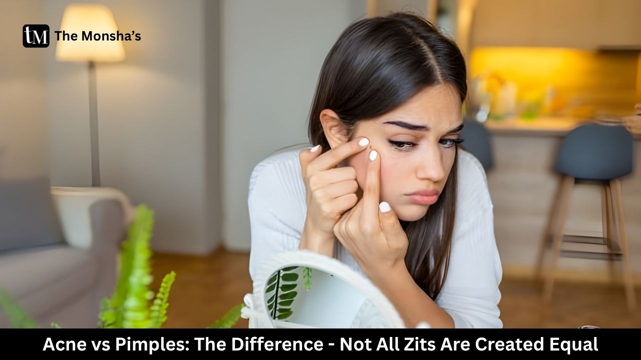 Acne vs Pimples: The Difference - Not All Zits Are Created Equal