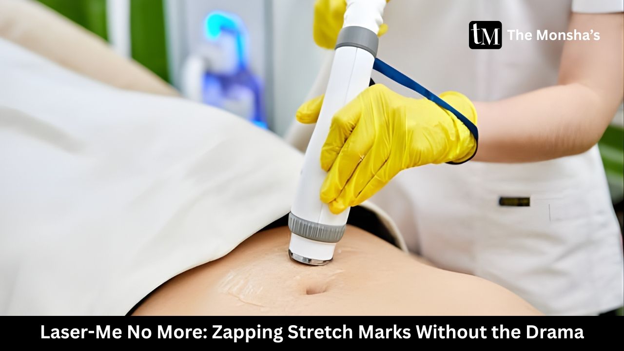 Laser-Me No More: Zapping Stretch Marks Without the Drama