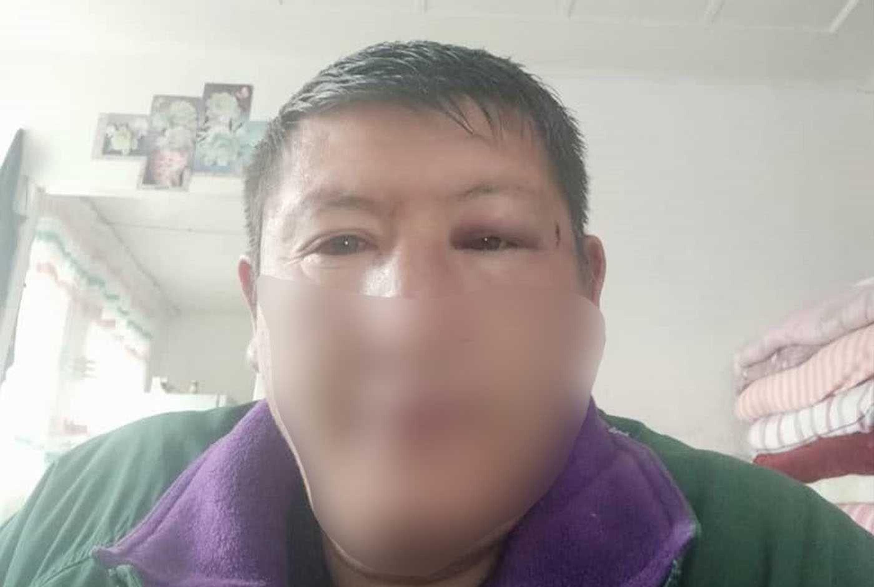 Golpeado por compartir el Evangelio