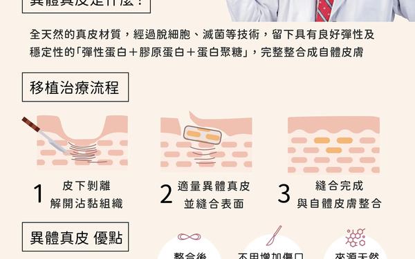 異體真皮 (ADM) 深度解析：一種免開第二刀的永久性填補選擇