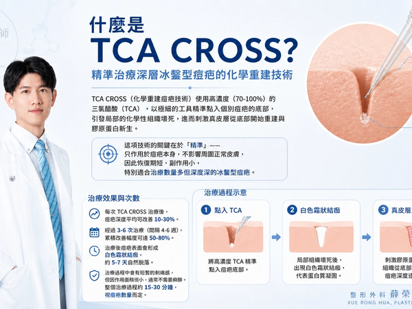 TCA CROSS