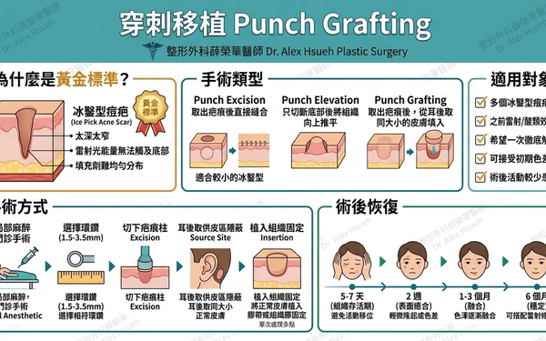 穿刺移植與切縫手術：針對頑固冰鑿型痘疤的手術解法。