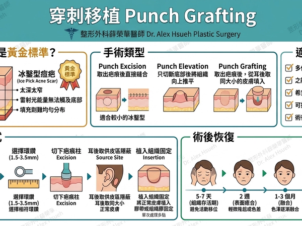 穿刺技術 (切縫與移植) 