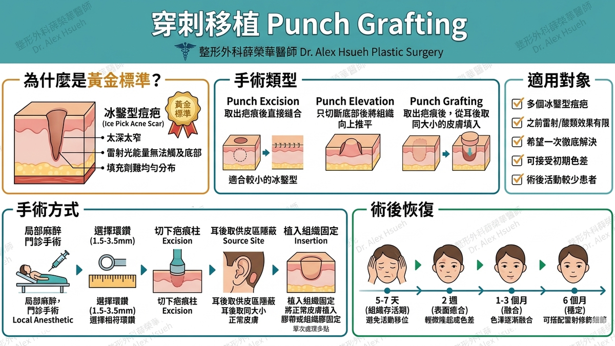 手術武器一：局部切縫手術 (Punch Excision) — 「去舊換新」  這是有感改善冰鑿型痘疤最乾脆、也最有效的方法。