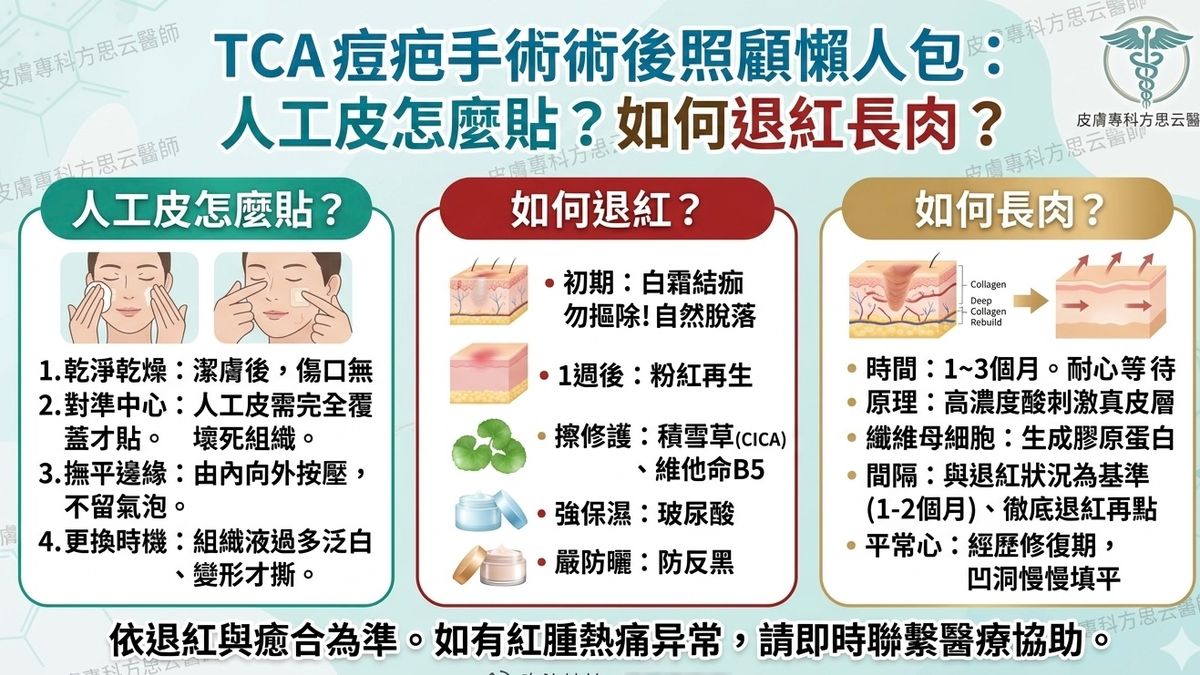 TCA 痘疤手術術後照顧懶人包：人工皮怎麼貼？如何退紅長肉？