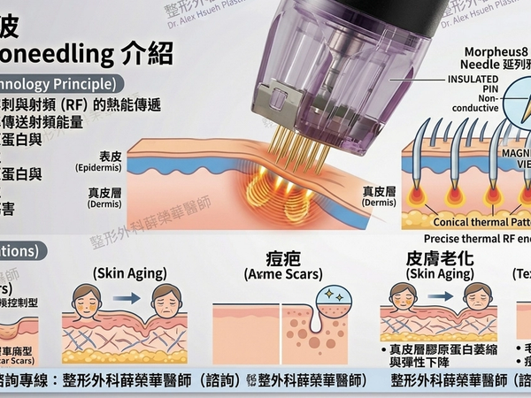 微針電波