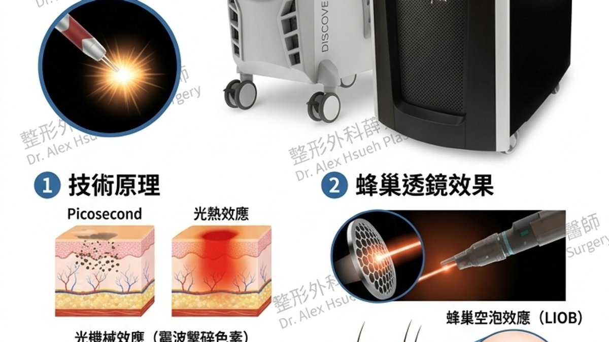 以極短脈衝時間擊碎色素顆粒，同時透過聚焦透鏡（蜂巢透鏡）產生空泡效應，刺激膠原蛋白重組，改善淺層紋理與色素沉澱。