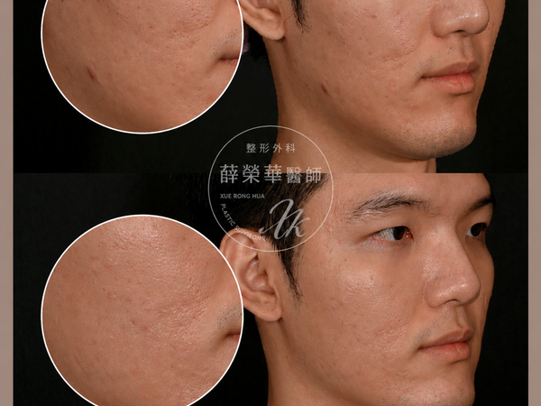 右側45度角