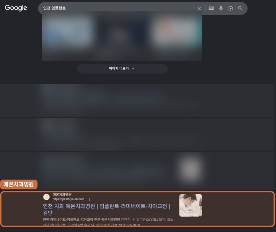“인천 임플란트”에서 확인된 Google 노출 화면