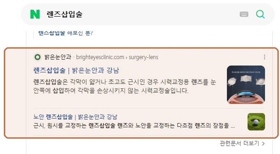 “렌즈삽입술”에서 확인된 Naver 노출 화면