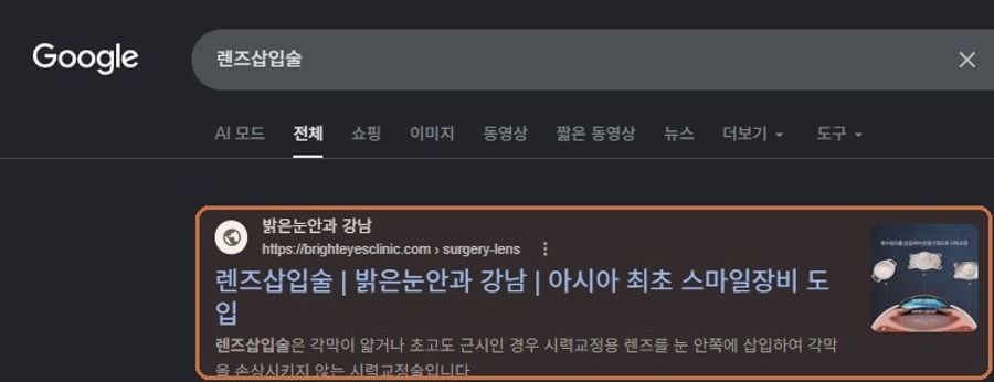 “렌즈삽입술”에서 확인된 Google 노출 화면