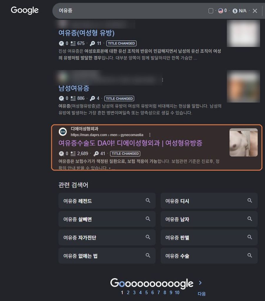 “여유증”에서 확인된 Google 노출 화면
