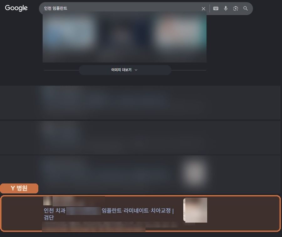 “인천 임플란트”에서 확인된 Google 노출 화면