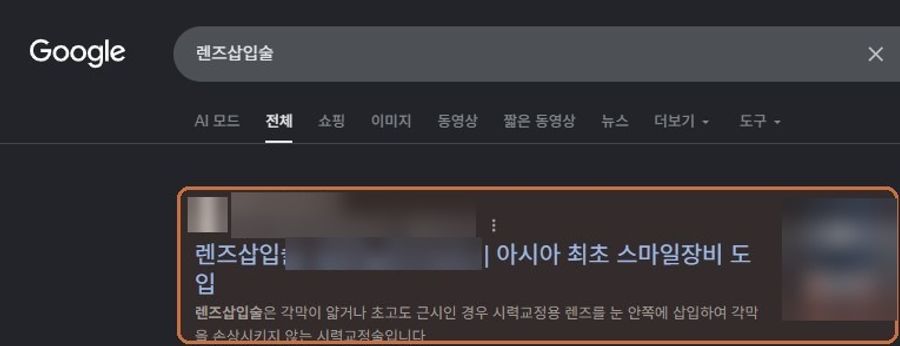 “렌즈삽입술”에서 확인된 Google 노출 화면