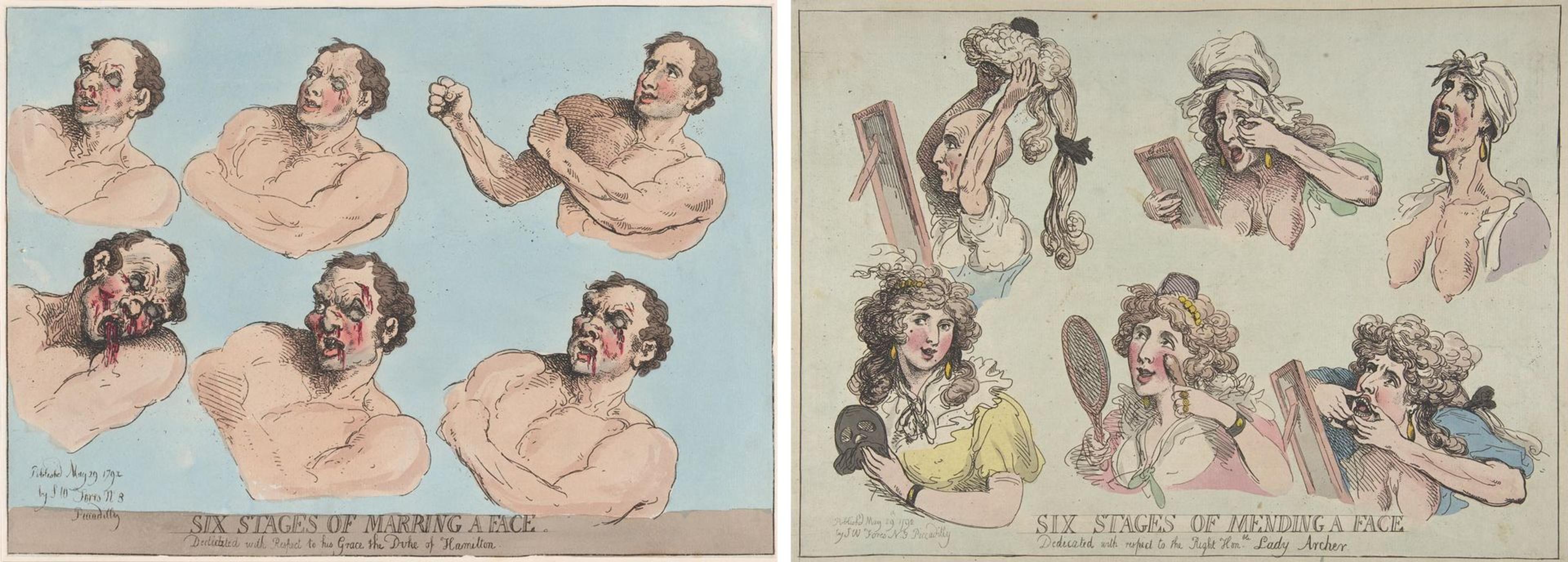 Two Thomas Rowlandson etchings from 1792 depicting various facial injuries (left) and how to mend them (right)