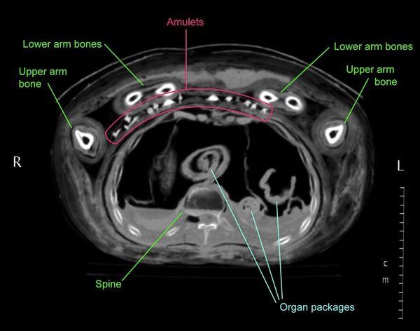 CT scan of Nesmin from 1997 that shows a section of the chest with the amulets.