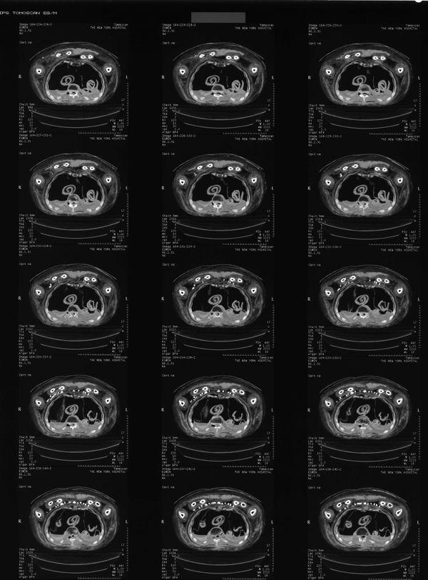 Example of old film sheet with CT scan images of Nesmin from 1997