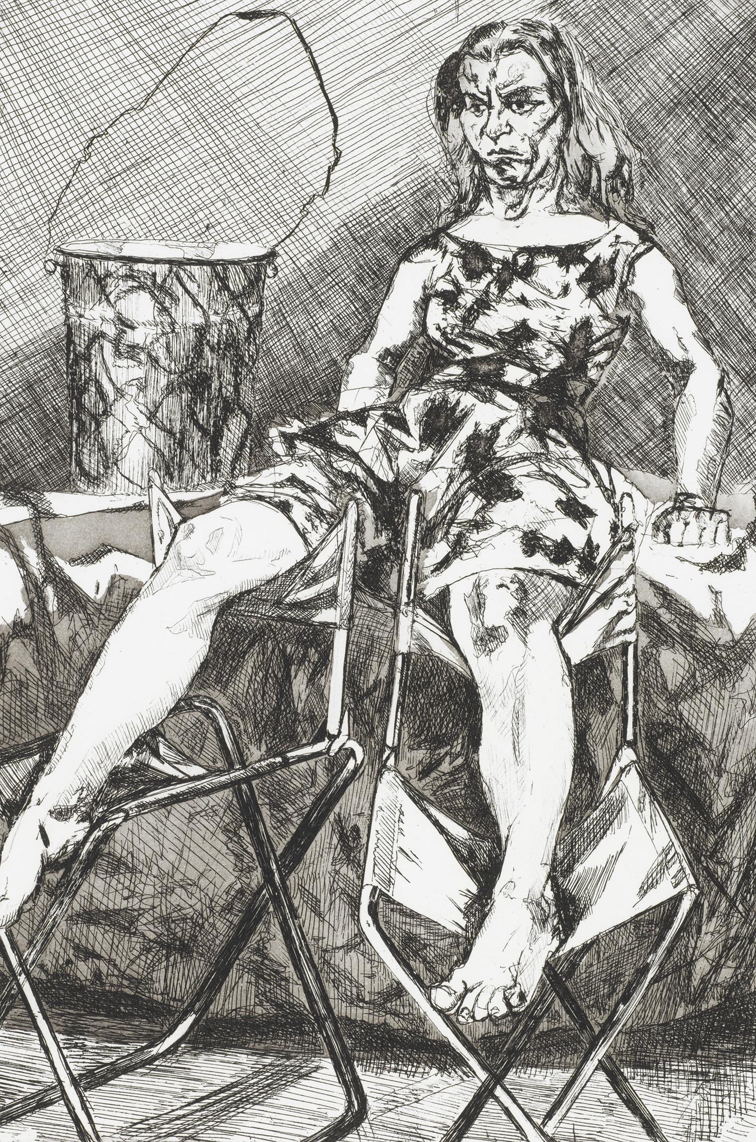 Woman sitting appearing bruised.