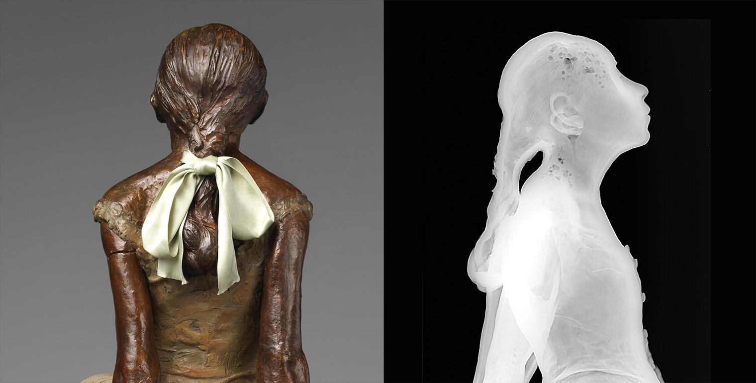 On the left, the Little Dancer seen from the back, her braid tied with a satin bow; on the right, a black-and-white x-ray profile view.