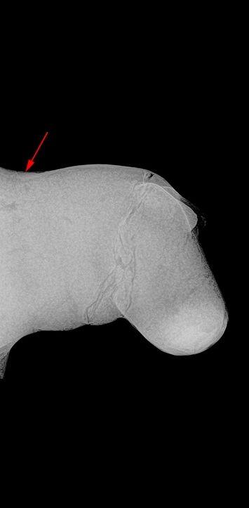 Black and white radiograph of William's head and neck