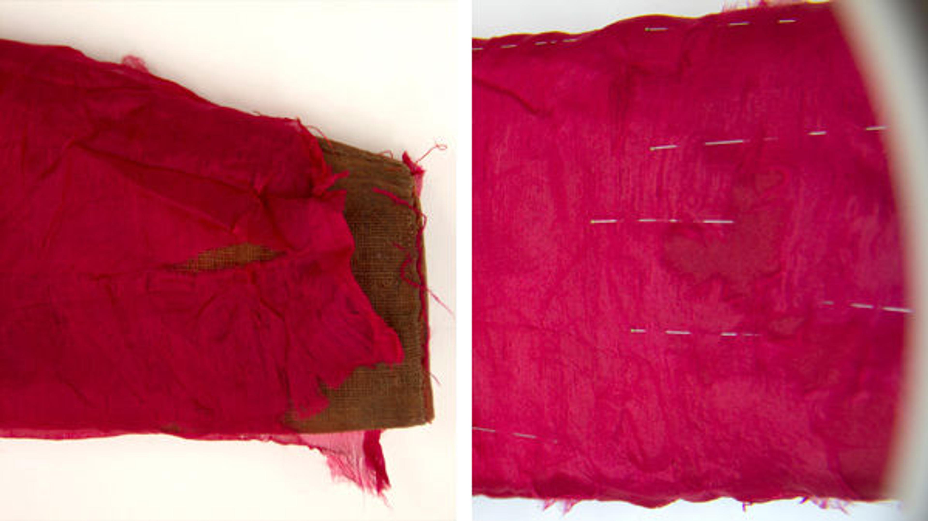 Jacket sleeve prior to treatment (top); jacket sleeve during treatment, showing the placement of a new fabric insertion