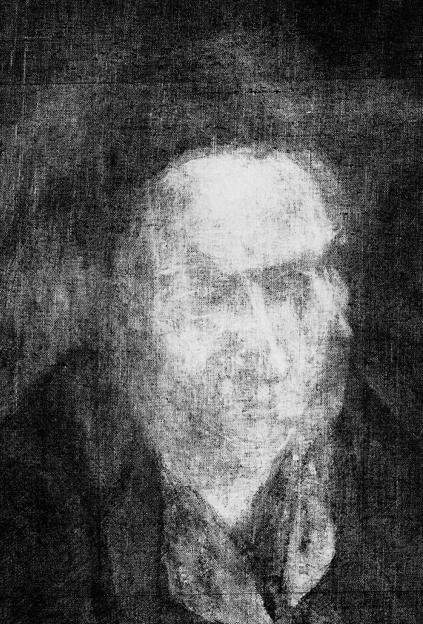 Black-and-white radiograph showing various early stages of Gertrude Stein's face