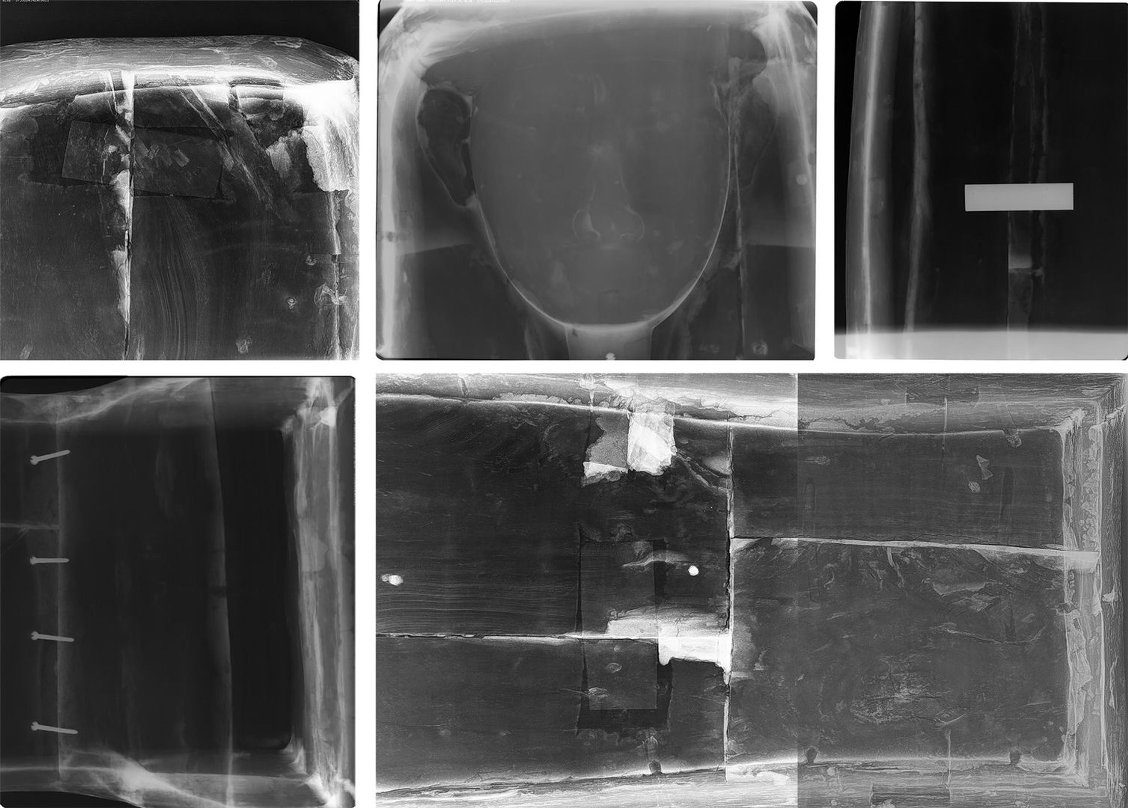 2: Five x-ray images of a wooden statue. Top left: a thick, horizontal shaded white line above swirls of dark gray. Center top: a shadowy face with prominent ears. Top right: vertical white line to left with a light gray rectangle in the center of the image over a dark field. Bottom left: four horizontal screws appear to join two shadowy rectangles on the left to a larger block on the right. Bottom right: two rectangles on the left bisected left to right. Divided vertically from two rectangles on the right bisected the same way.