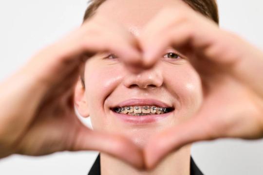 Dantų laminatės: ar jūsų odontologas pasako visą tiesą apie jų ilgalaikiškumą?