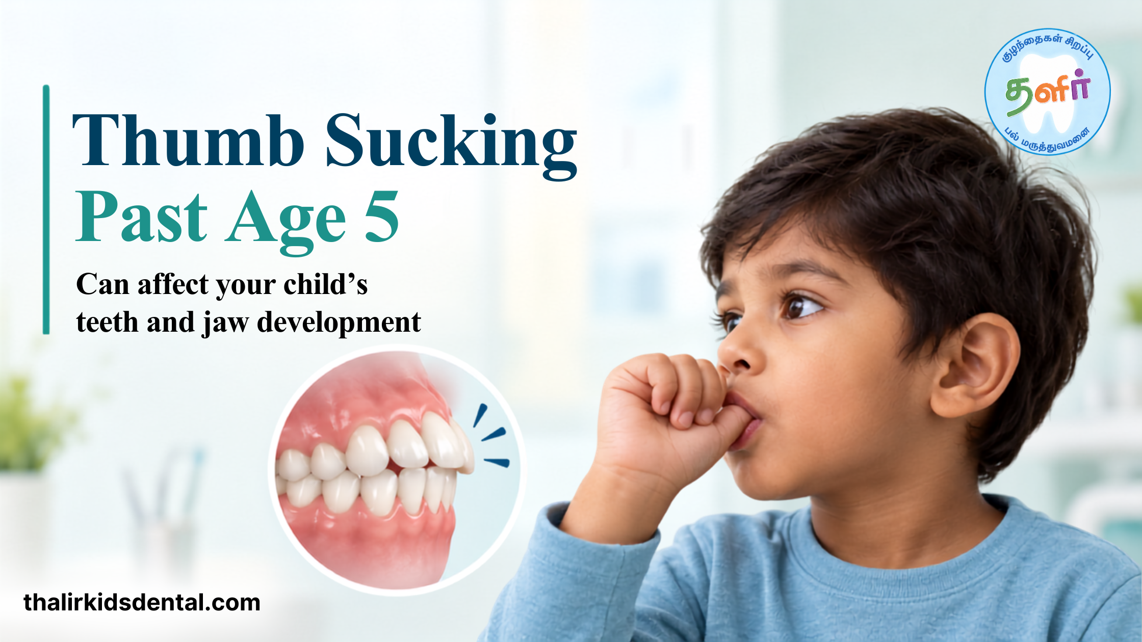 Thumb Sucking Past Age 5: When It Becomes an Orthodontic Concern