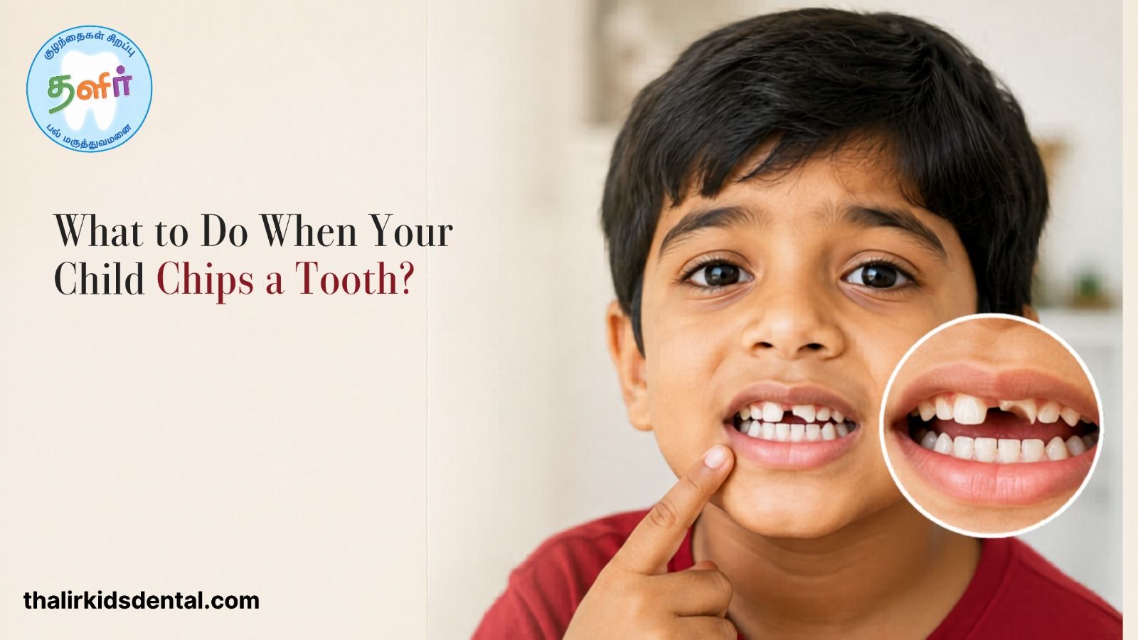 What to Do When Your Child Chips a Tooth by Thalir?