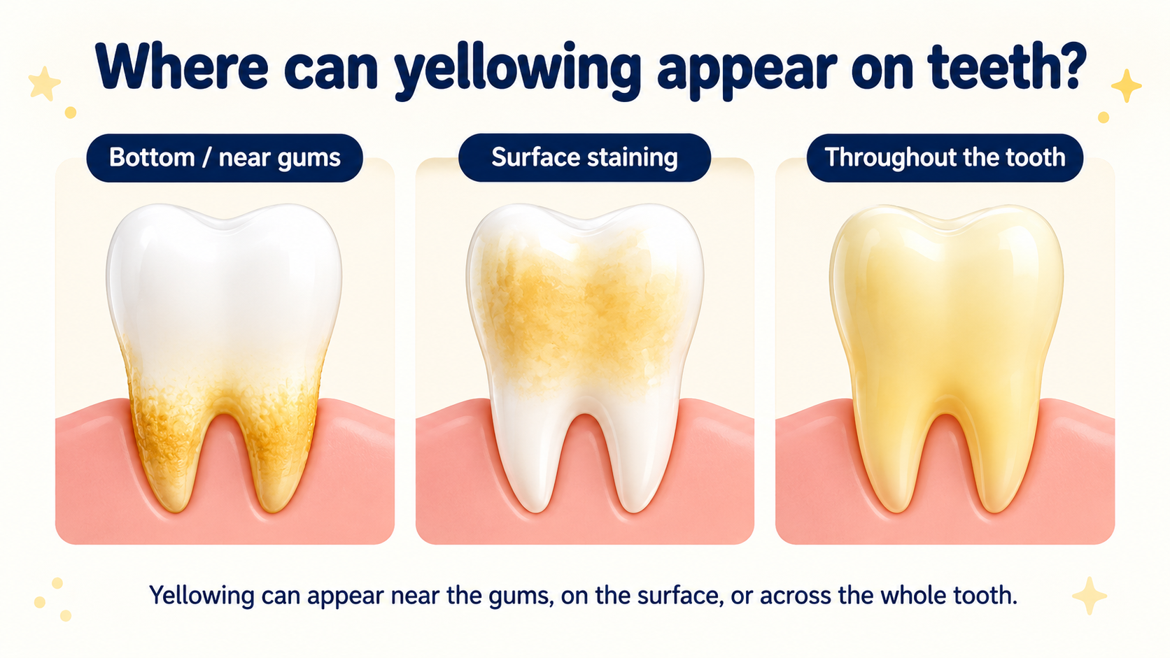 Yellow teeth on Kids