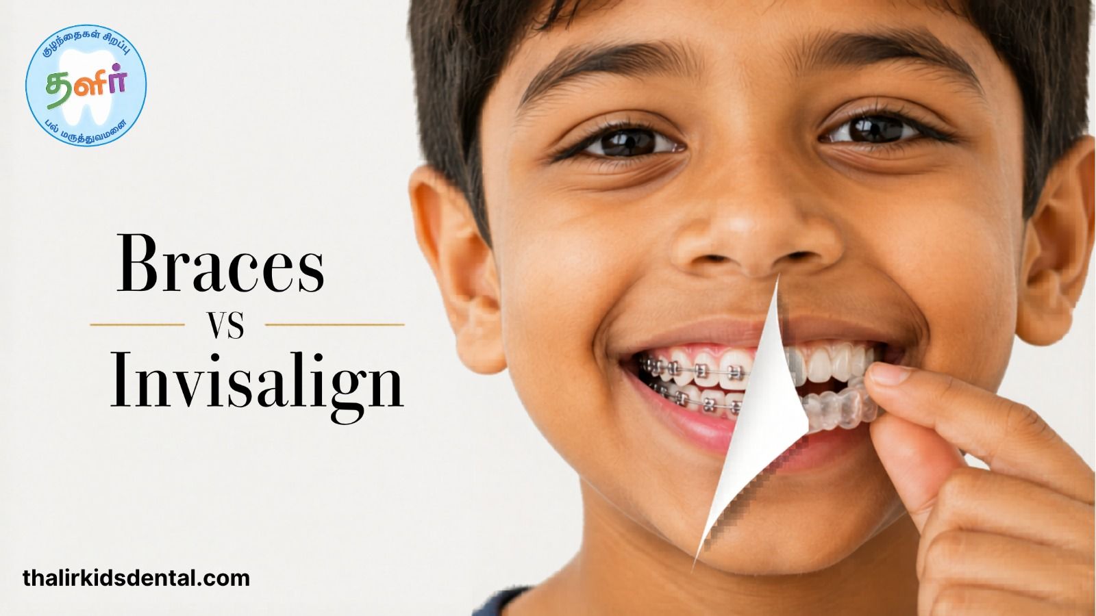 Braces for Kids vs Invisalign What Every Parent Should Know