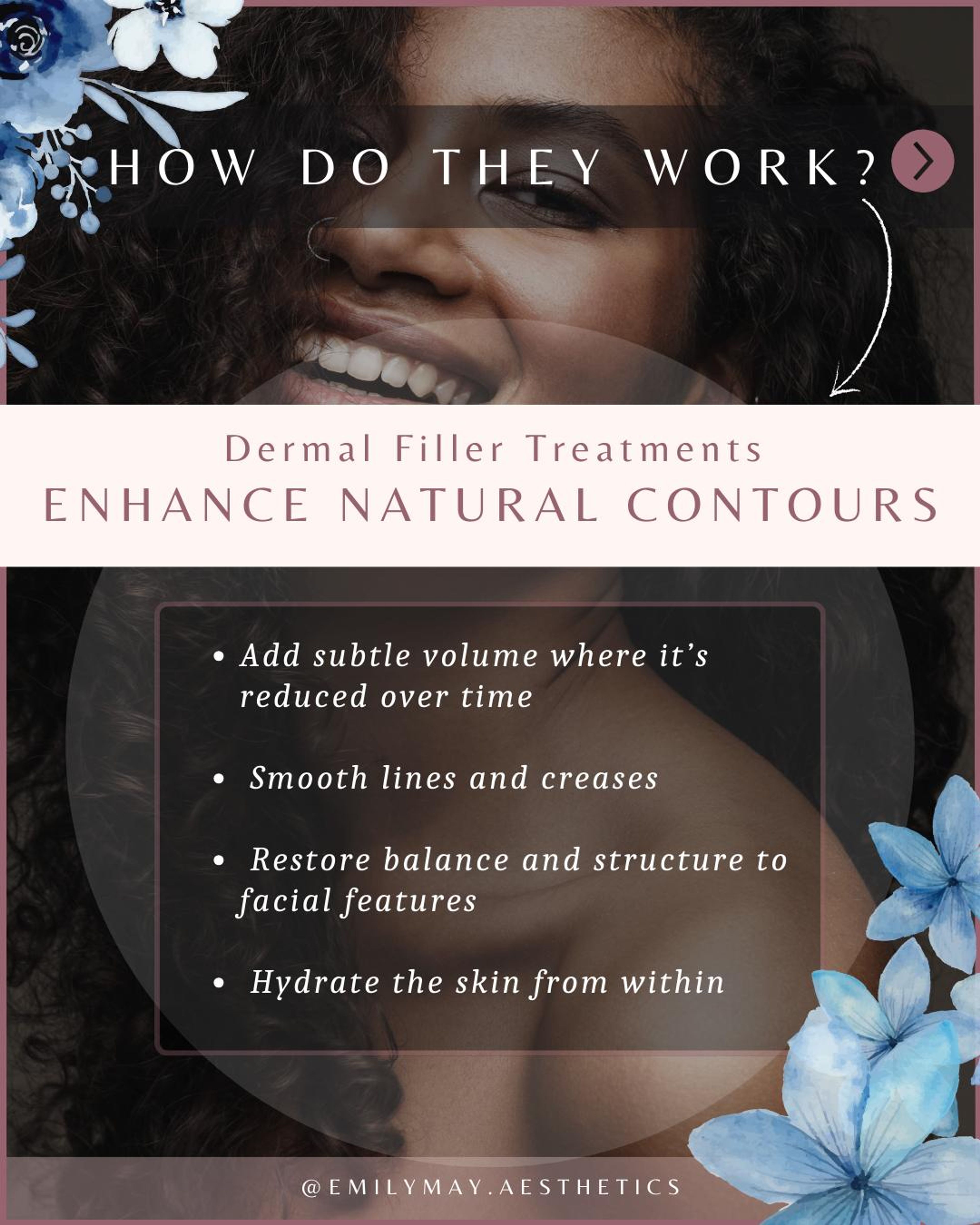 Dermal filler slide explaining how the treatment enhances natural contours