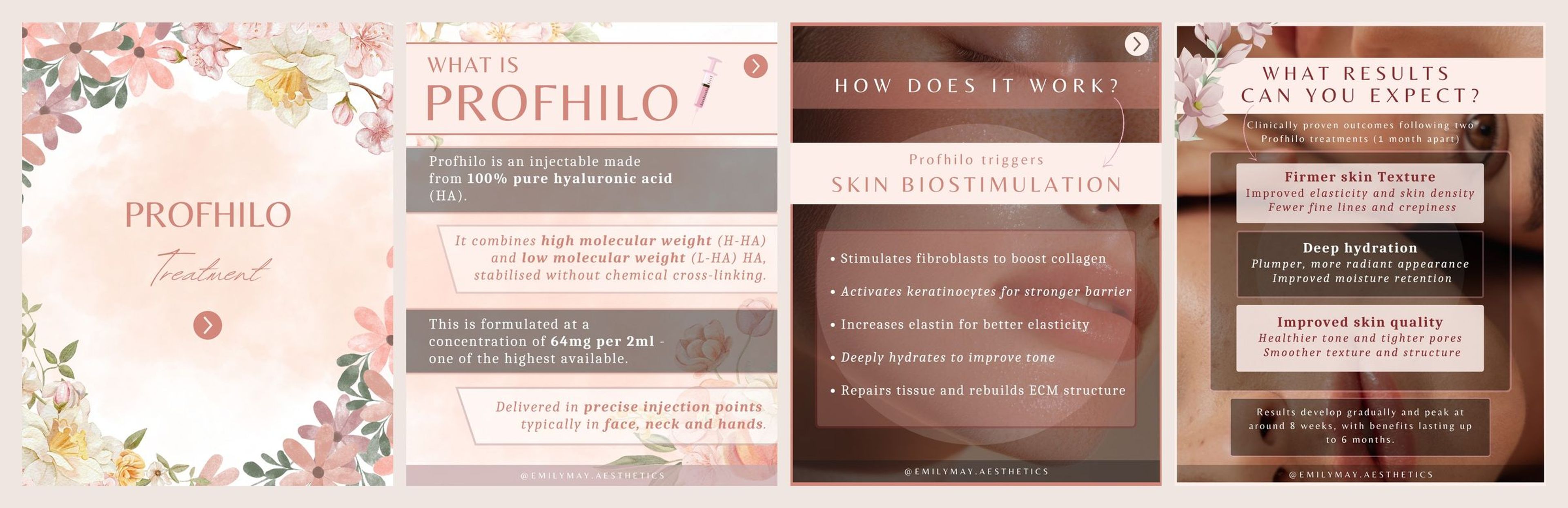 The four slides of the Profhilo treatment highlight carousel