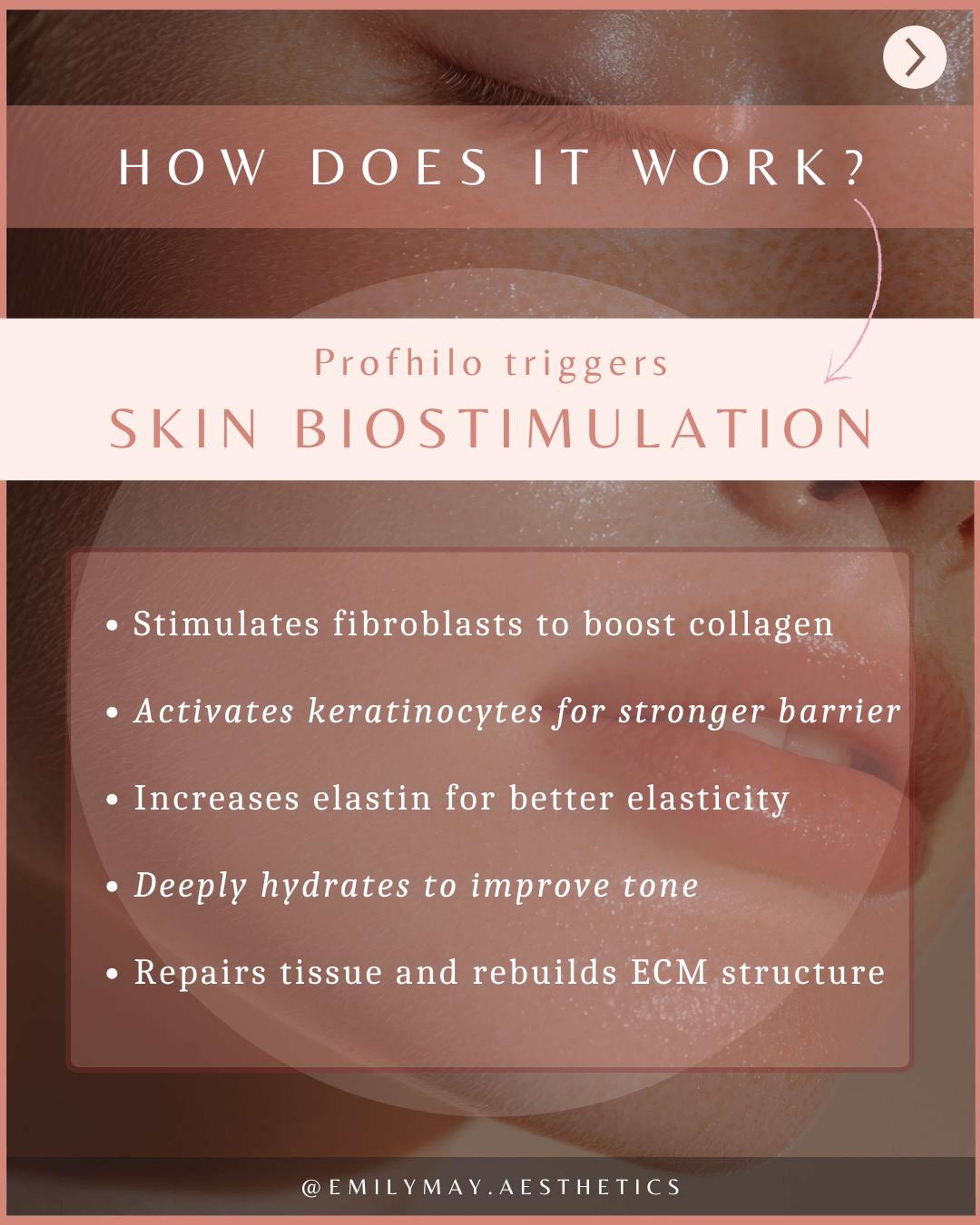 Profhilo slide explaining how the treatment works through skin biostimulation
