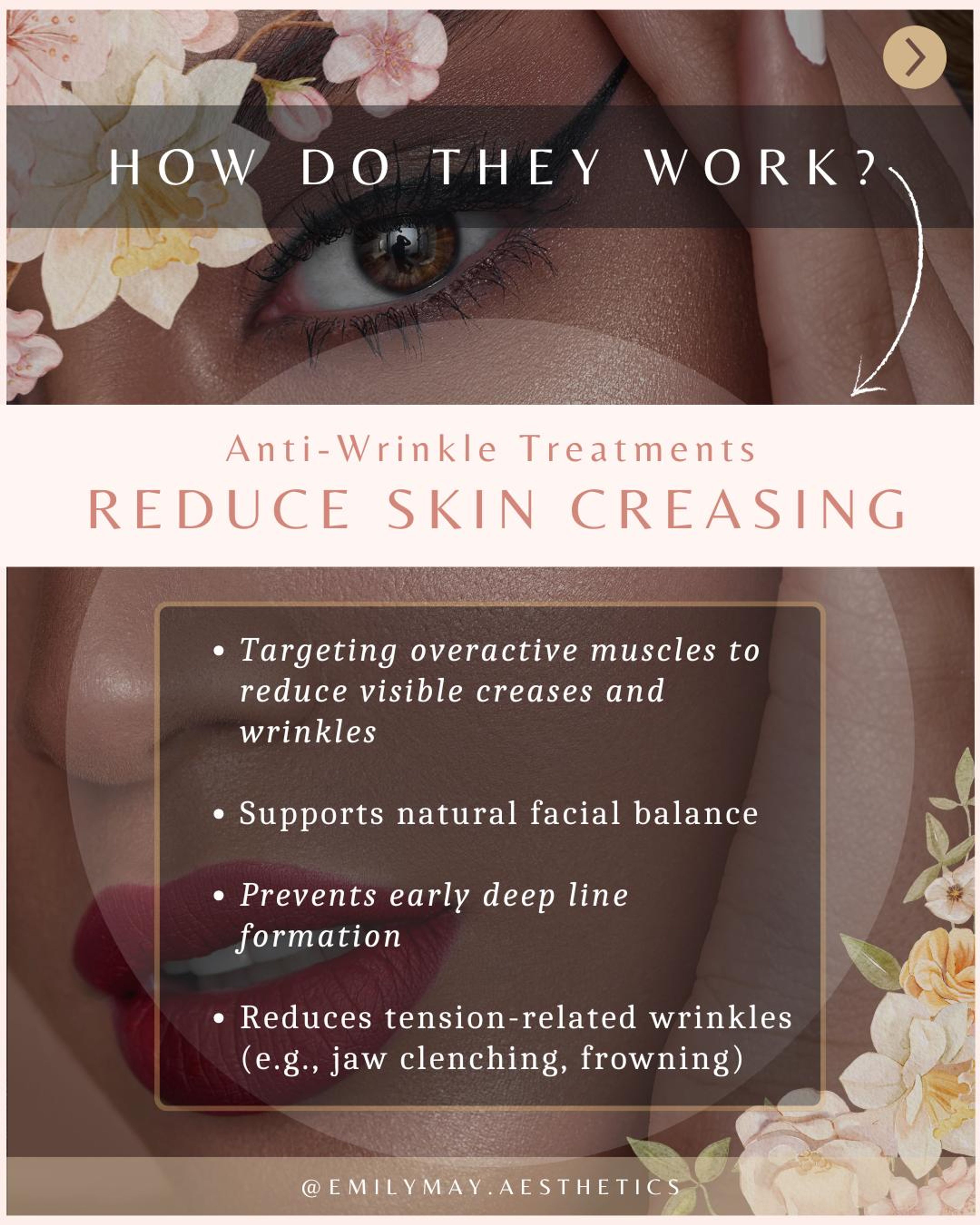 Anti-wrinkle slide explaining how the treatment reduces skin creasing