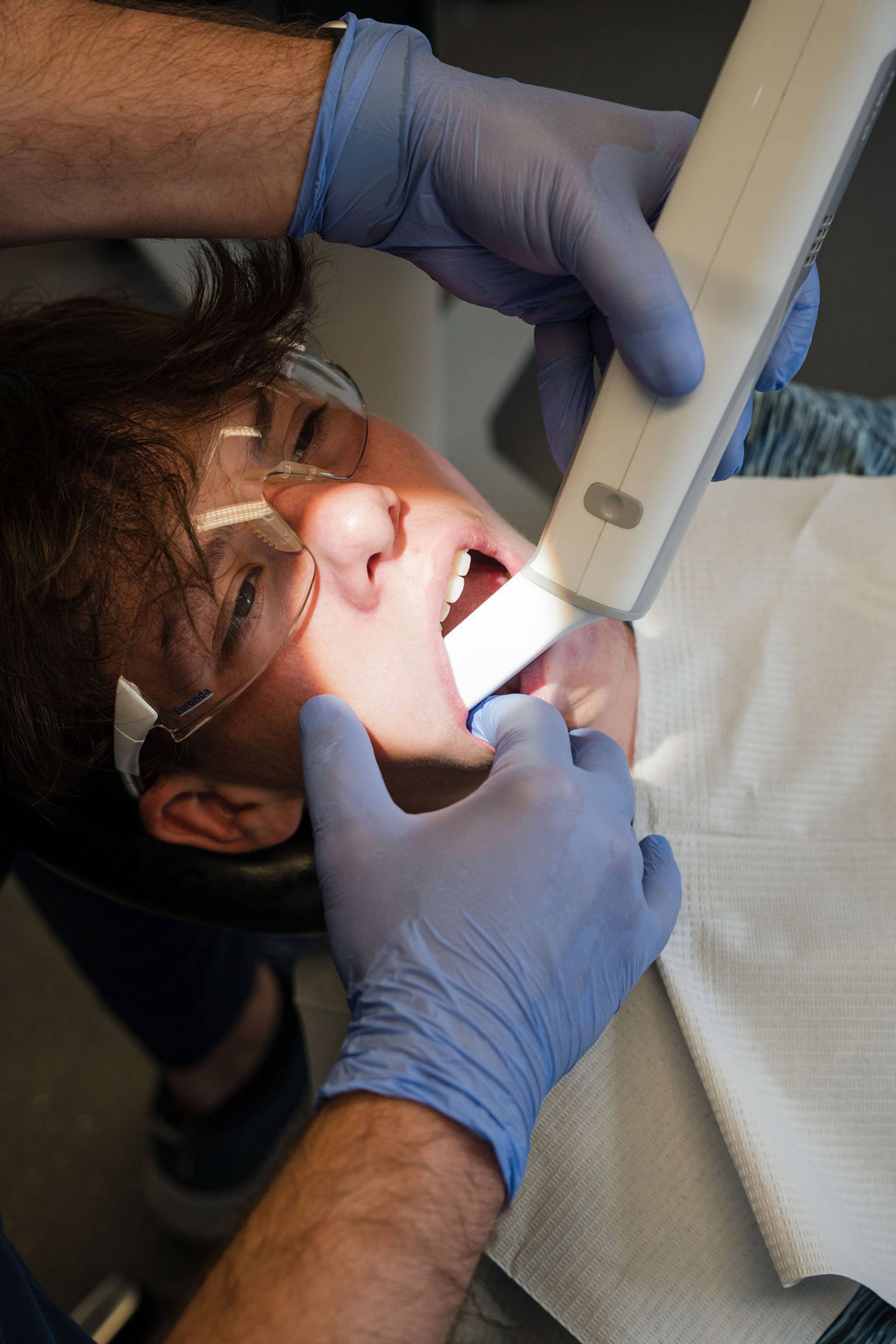 Cosmetic dentistry consultation using an intraoral scanner to create precise digital impressions for smile enhancement treatments.