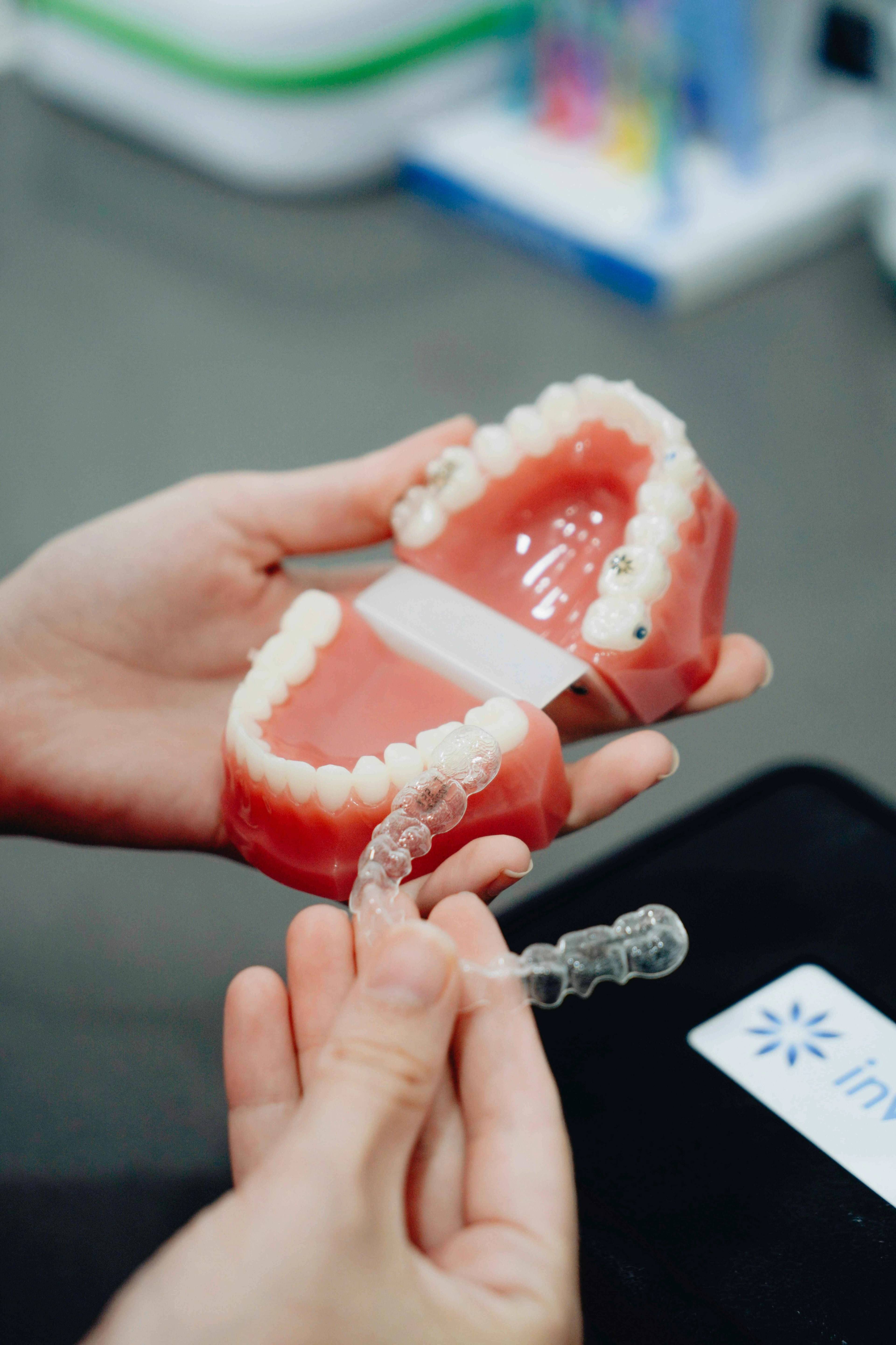 Clear aligner tray being demonstrated on a dental model during an orthodontic consultation for Invisalign treatment.