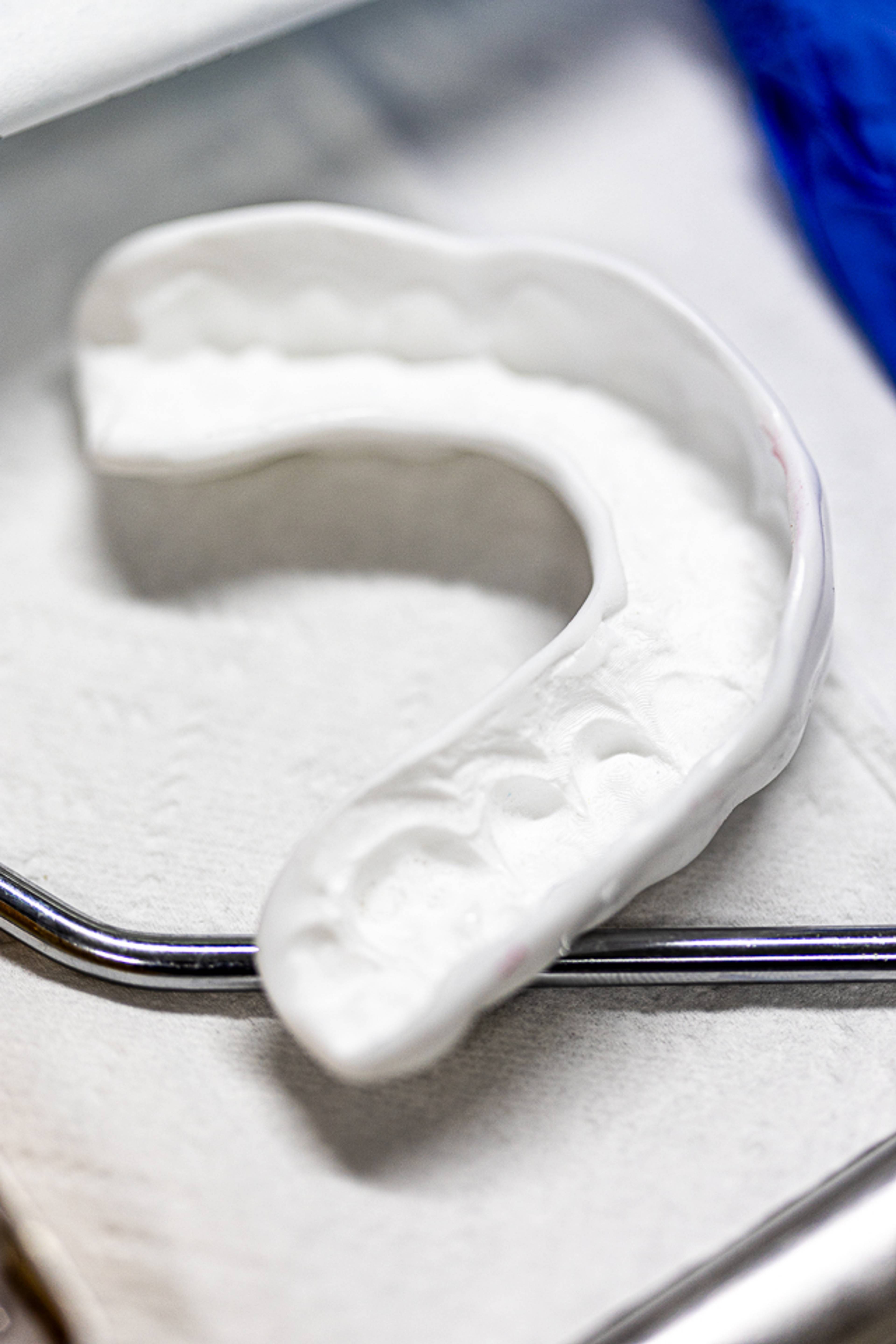 Close-up of a white dental impression tray containing a mold of upper teeth, resting on a metal surface in a clinical setting. The image has a shallow depth of field, with parts of a blue glove visible in the blurred background.