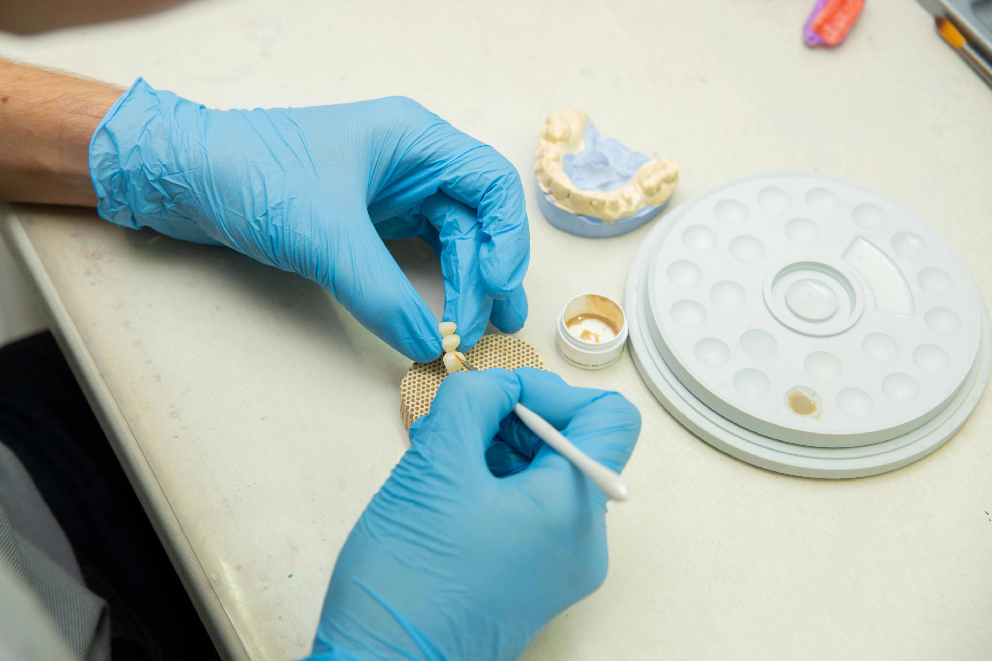 Dental technician crafting a dental restoration on a workbench using precision tools and a dental model.