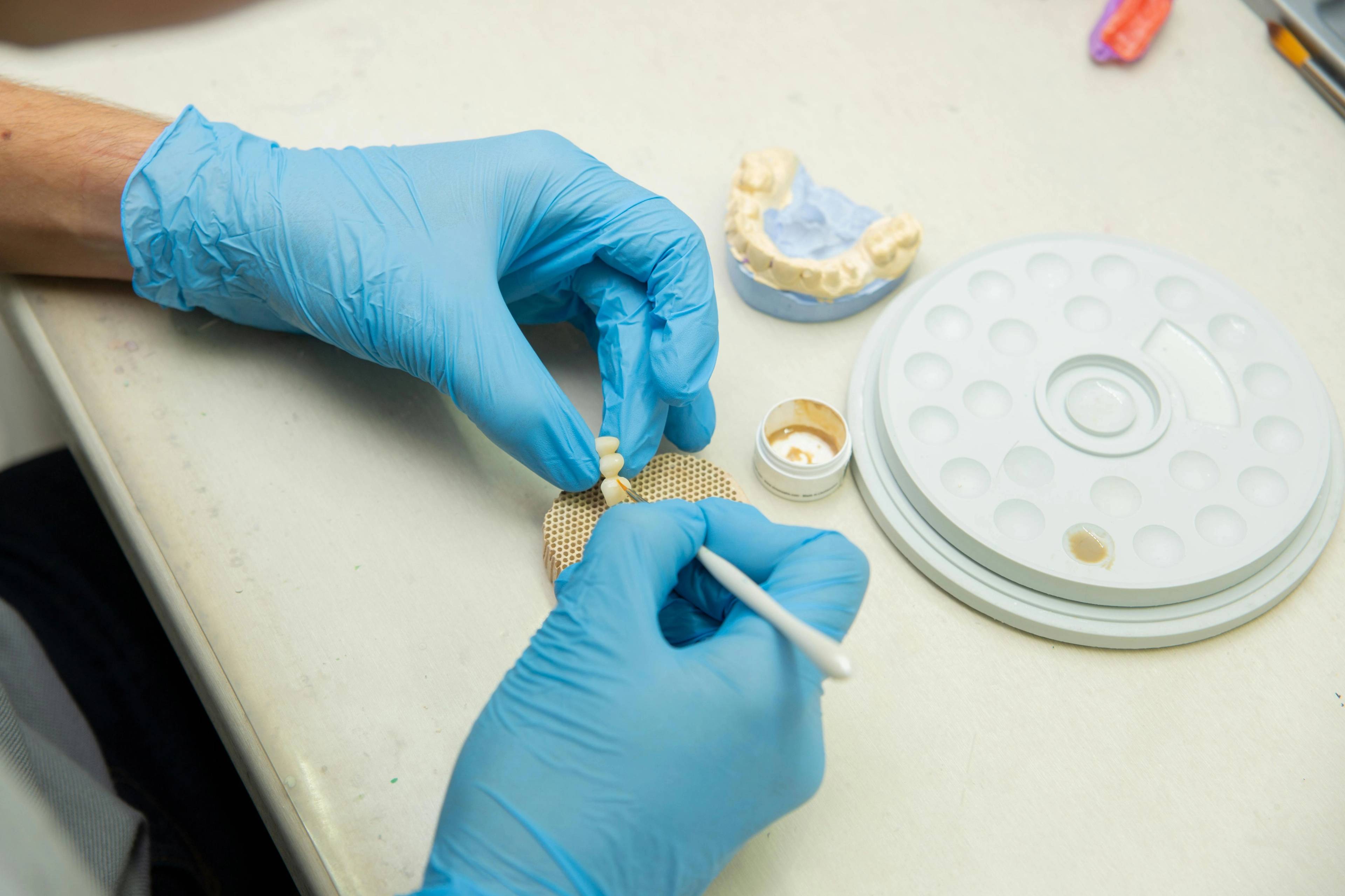 Dental technician crafting a dental restoration on a workbench using precision tools and a dental model.