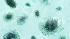 Microplastic particles and synthetic polymer fragments floating in a contaminated water environmen